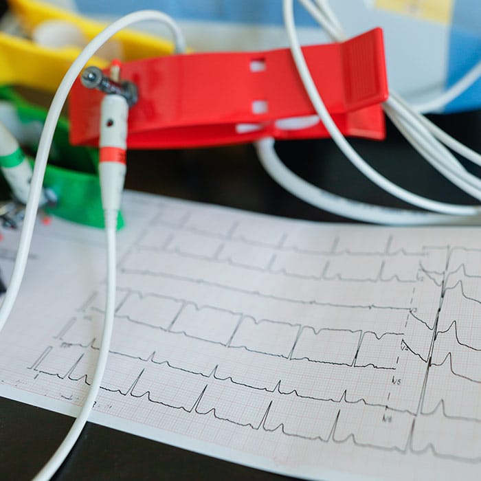 Cavi-ecg