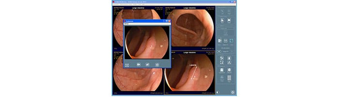 acquisizione-dicom-per-video-e-immagini