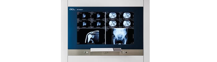 sistemi-e-attrezzature-per-sale-operatorie