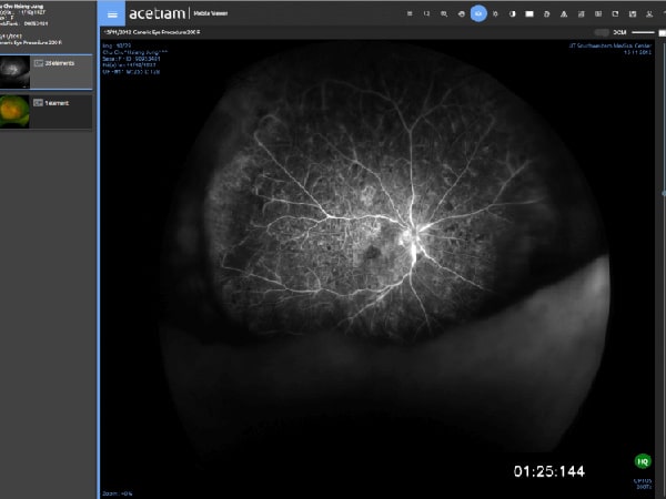 software-visualizzatore-file-dicom