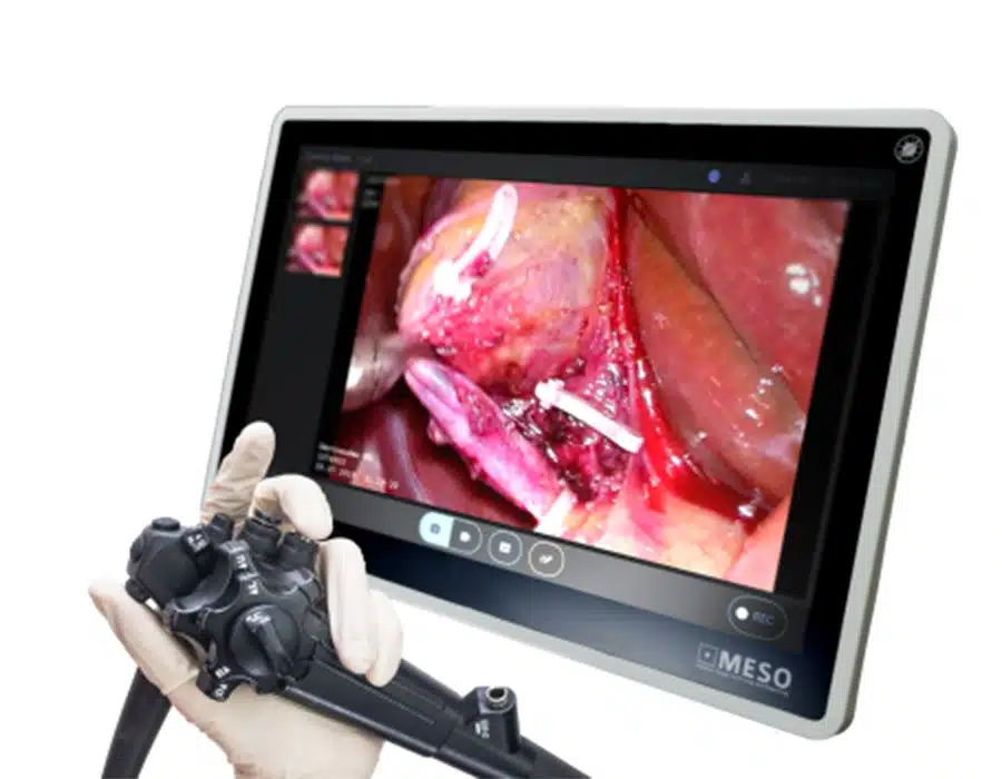 ibox-touch-per-endoscopia